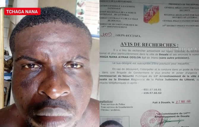 Horreur à Ndogpassi 3 : Bébé Amélie, 11 mois, tuée par son oncle en fuite après un différend familial