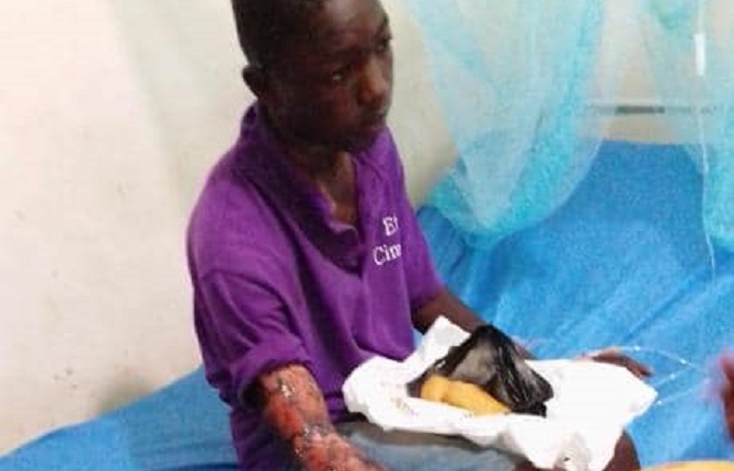 La femme d'un pasteur verse l'eau chaude sur un enfant qu'elle accuse de vol
