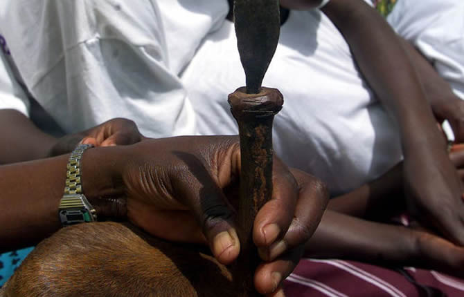Le taux de prévalence les mutilations génitales féminines est de 1,4% au Cameroun
