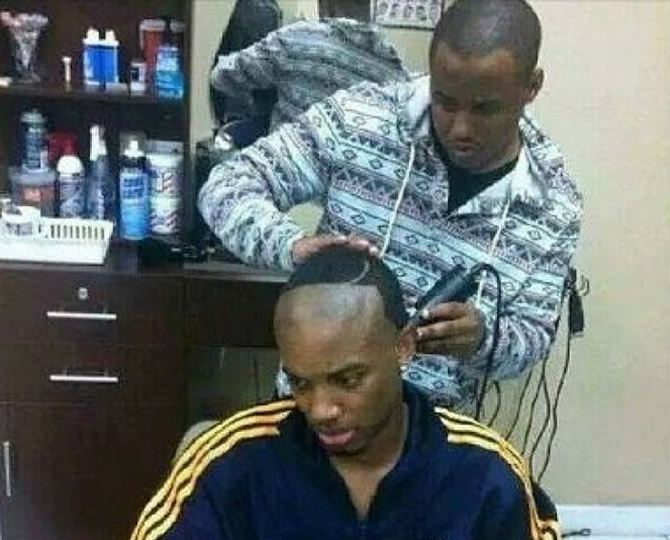 Coiffure : démi-calvitie zéro