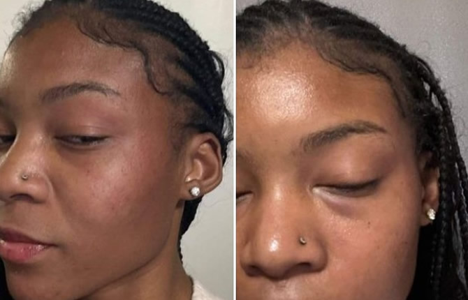 L'internationale camerounaise Mireille Tchengang victime d'agressions