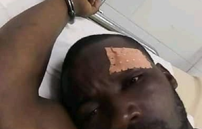 Un camerounais tabassé et jeté en prison par son employeur chinois alors qu'il réclamait son salaire